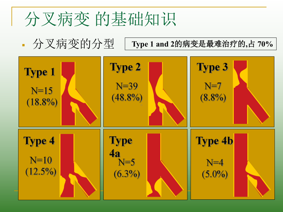 经桡动脉分叉病变的Kissing技巧课件.ppt_第3页