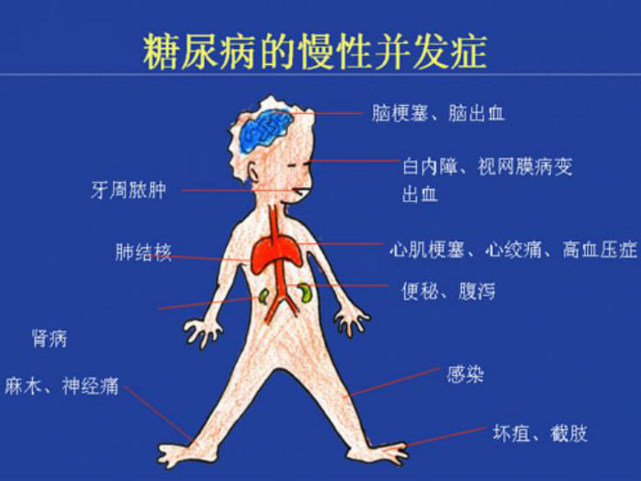 糖尿病预防诊断治疗课件.pptx_第3页