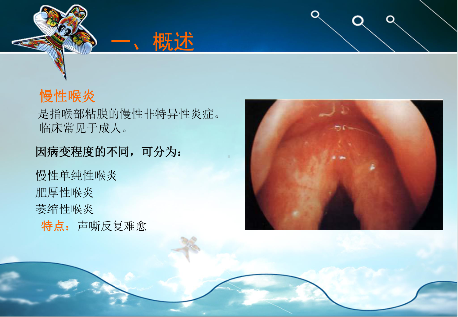 第八章咽喉科疾病喉喑课件.ppt_第2页