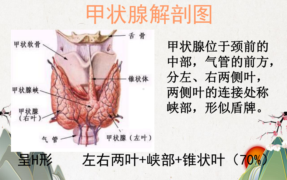 甲状腺的超声解读课件.pptx_第2页