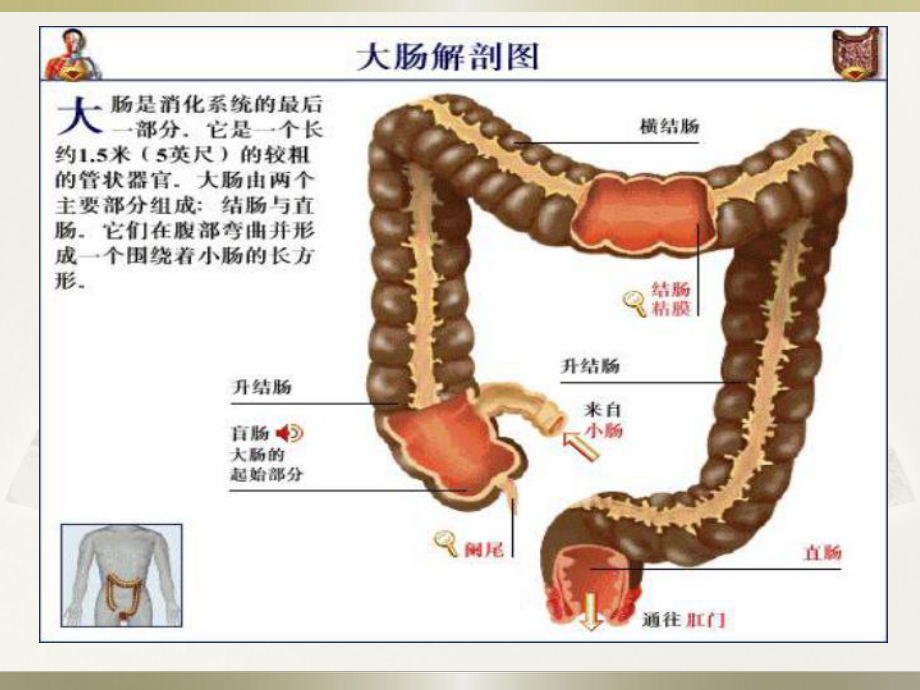 直肠癌的护理课件-2.ppt_第2页