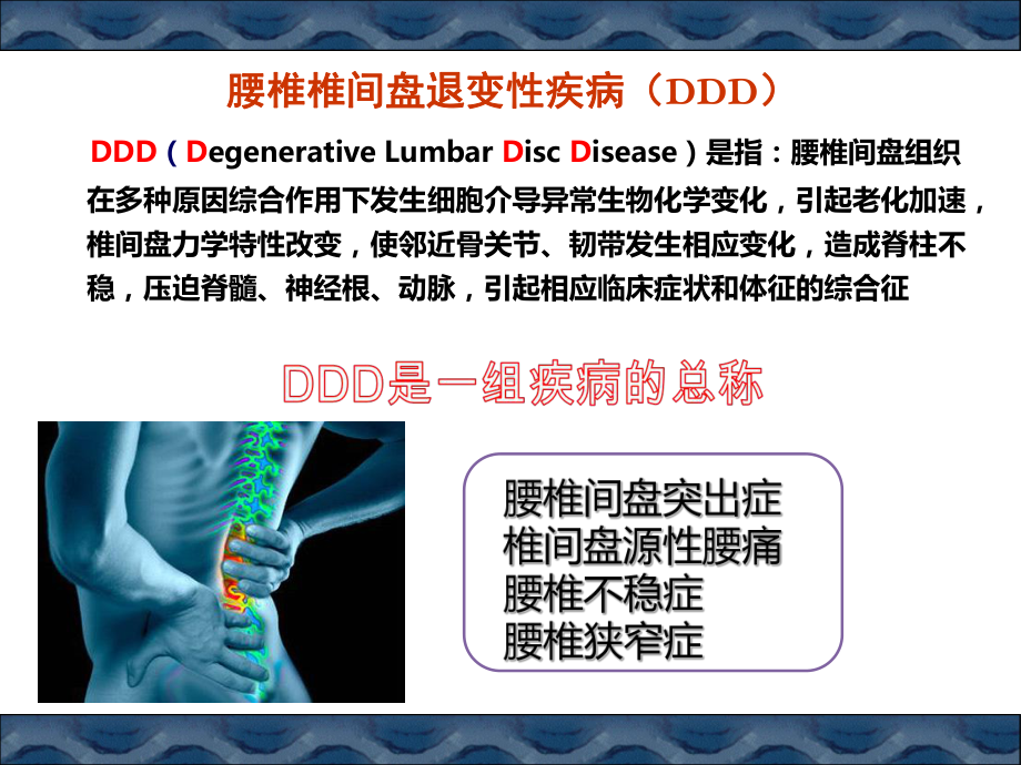 腰椎间盘退变性疾病医学课件.pptx_第2页