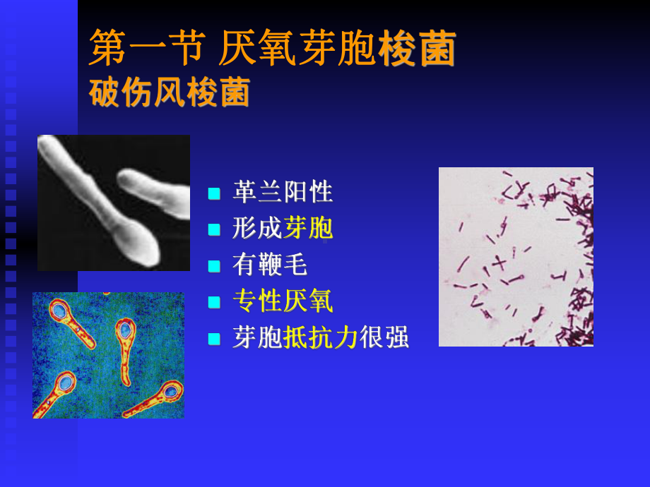 第十八章厌氧性细菌课件.ppt_第3页