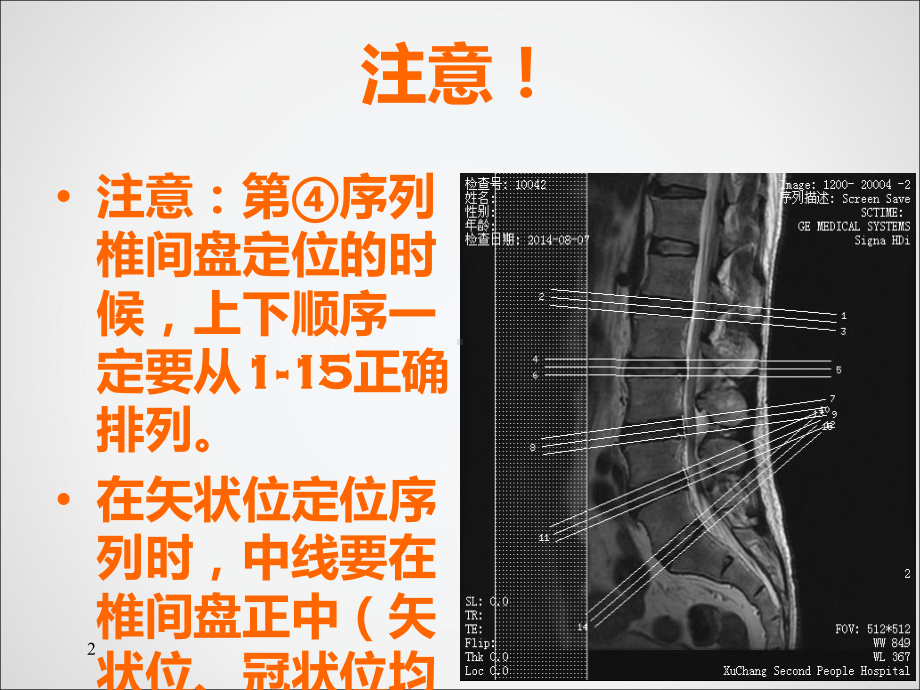 腰椎CT和MRI的区别课件.ppt_第3页