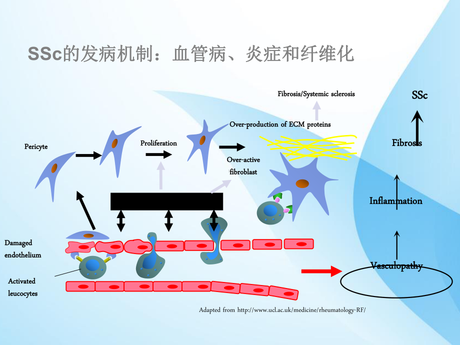 系统性硬化症课件-2.ppt_第3页