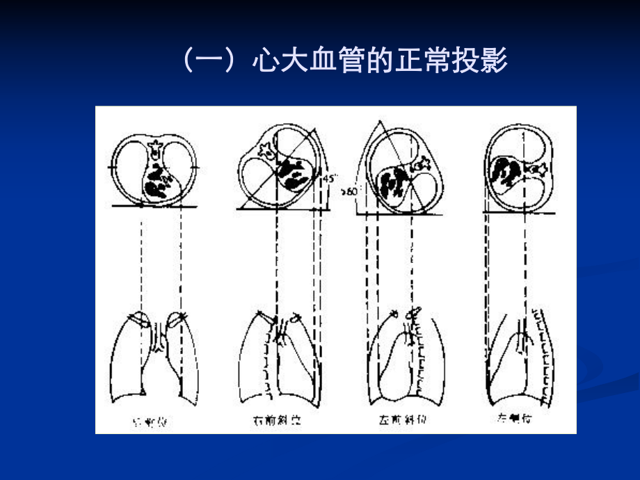 正常影像学表现(X线检查)课件.ppt_第2页