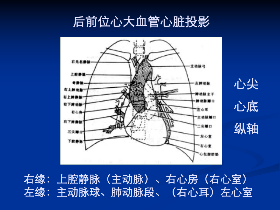 正常影像学表现(X线检查)课件.ppt_第3页