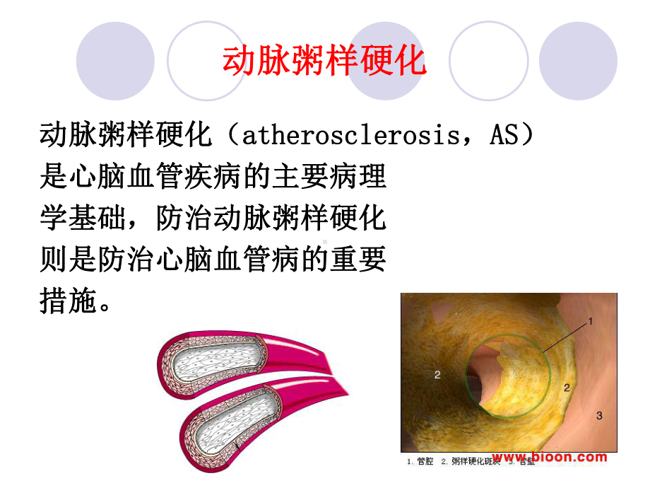 第14章抗动脉粥样硬化药课件.ppt_第2页