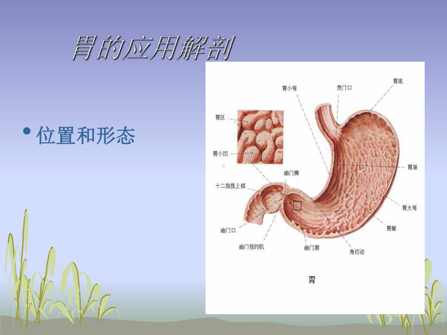 胃大部切除手术课件.ppt_第3页