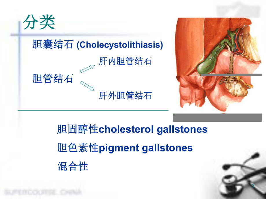 胆石症课件.ppt_第3页