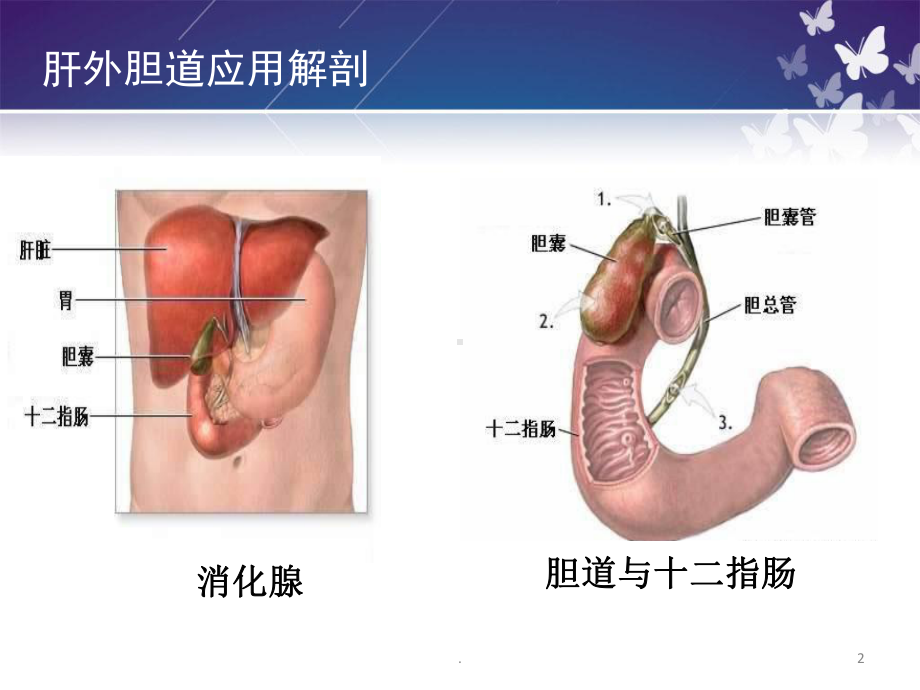 胆囊切除术教学查房医学课件.ppt_第2页