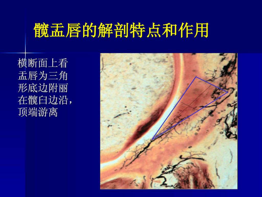 髋关节疼痛的一个病因股髋撞击征课件.ppt_第2页