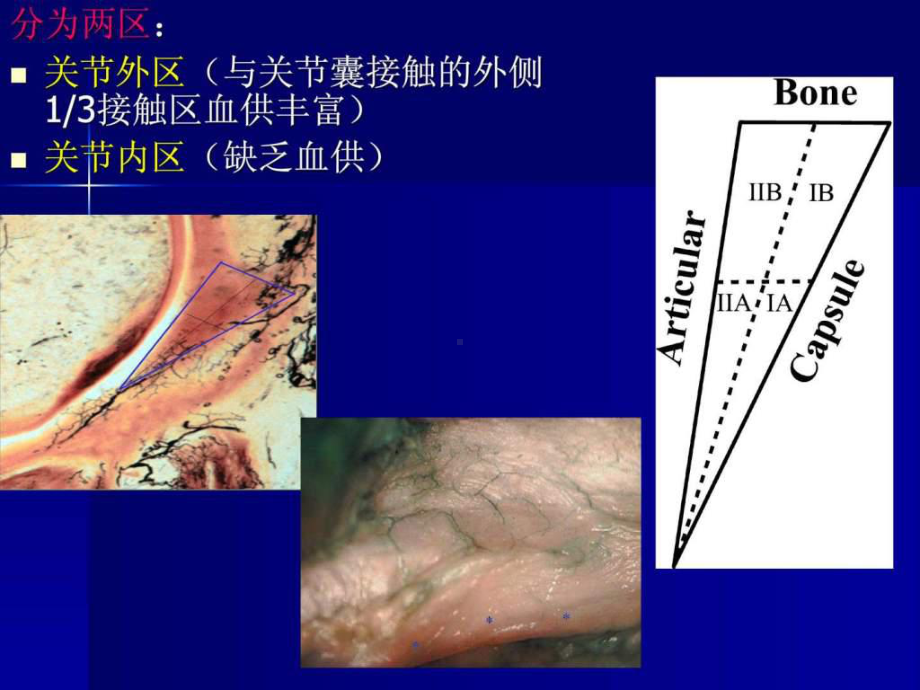 髋关节疼痛的一个病因股髋撞击征课件.ppt_第3页