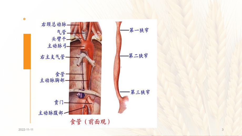 食管癌术后放疗护理查房(课堂)课件.pptx_第3页