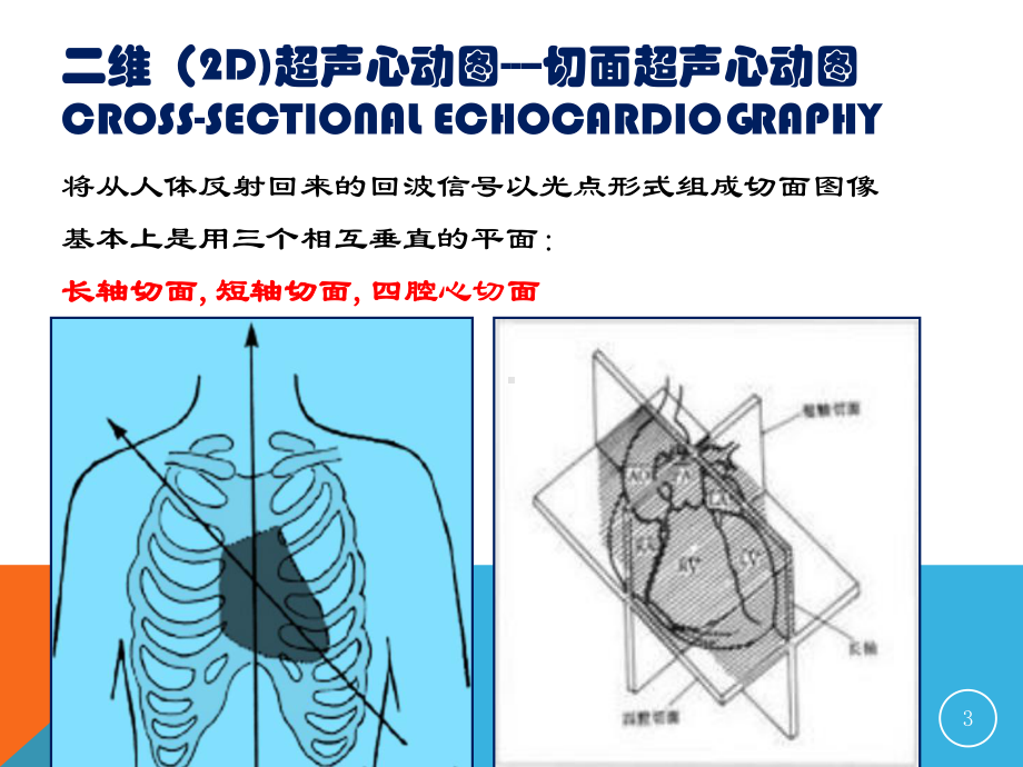 正常心脏的超声基础测量医学课件.ppt_第3页