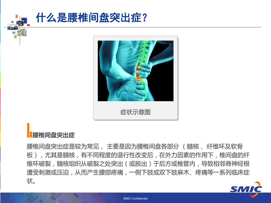 腰椎间盘突出症科普课件.ppt_第2页