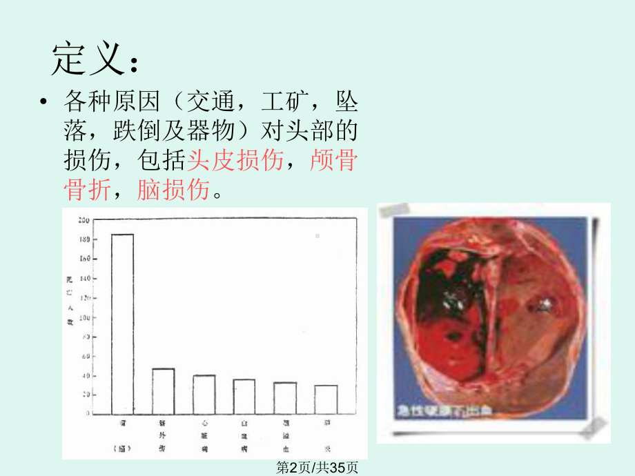 重型颅脑损伤教案课件.pptx_第2页