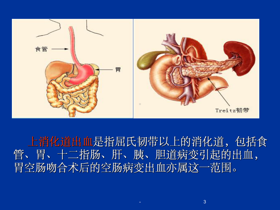 消化道出血护理查房-课件-.ppt_第3页