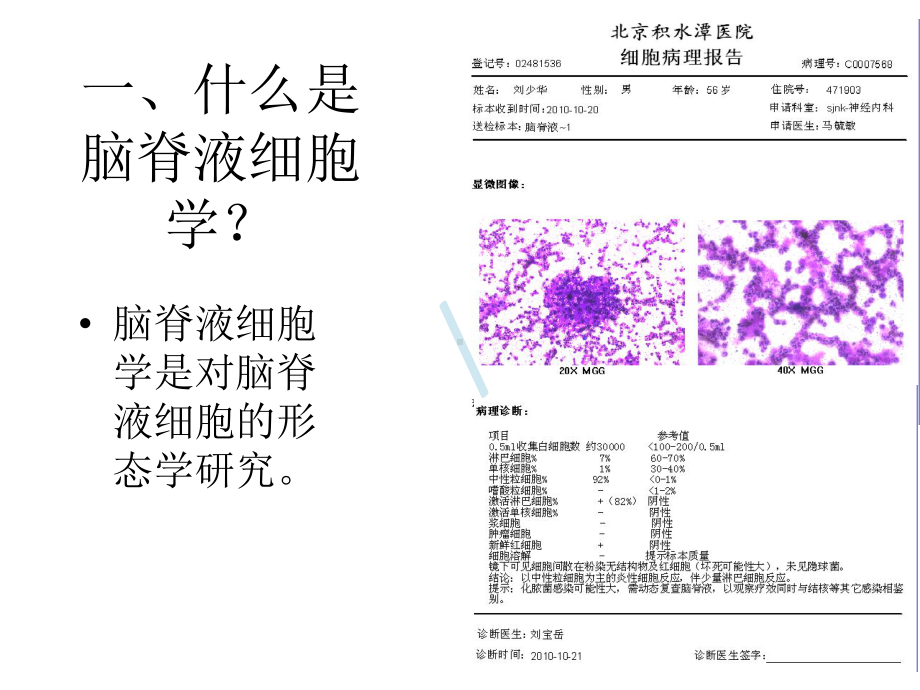 脑脊液细胞学概论课件.pptx_第2页