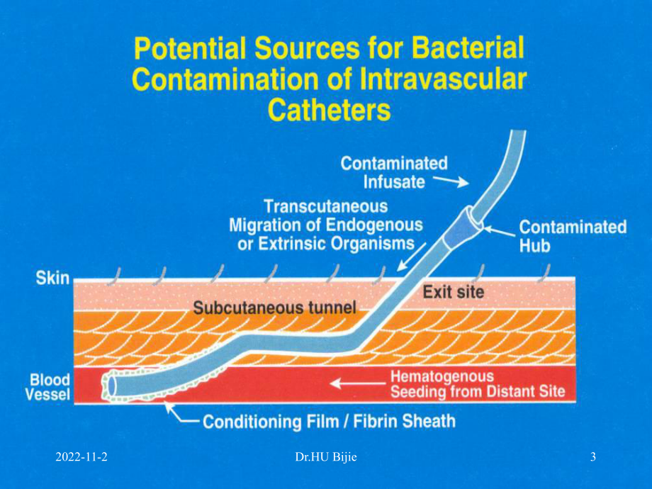 美国导管相关血流感染预防与控制技术指南的解析(课堂)课件.ppt_第3页