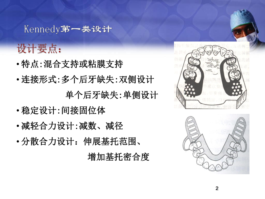 活动义齿(设计)医学课件.ppt_第2页