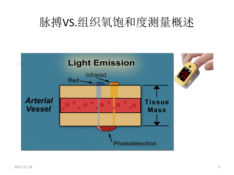 脑氧饱和度监测参考课件.ppt_第3页