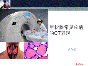 甲状腺常见疾病的CT表现课件.ppt