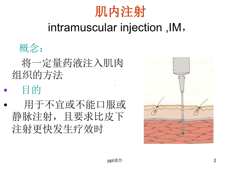 肌肉注射-课件.ppt_第2页