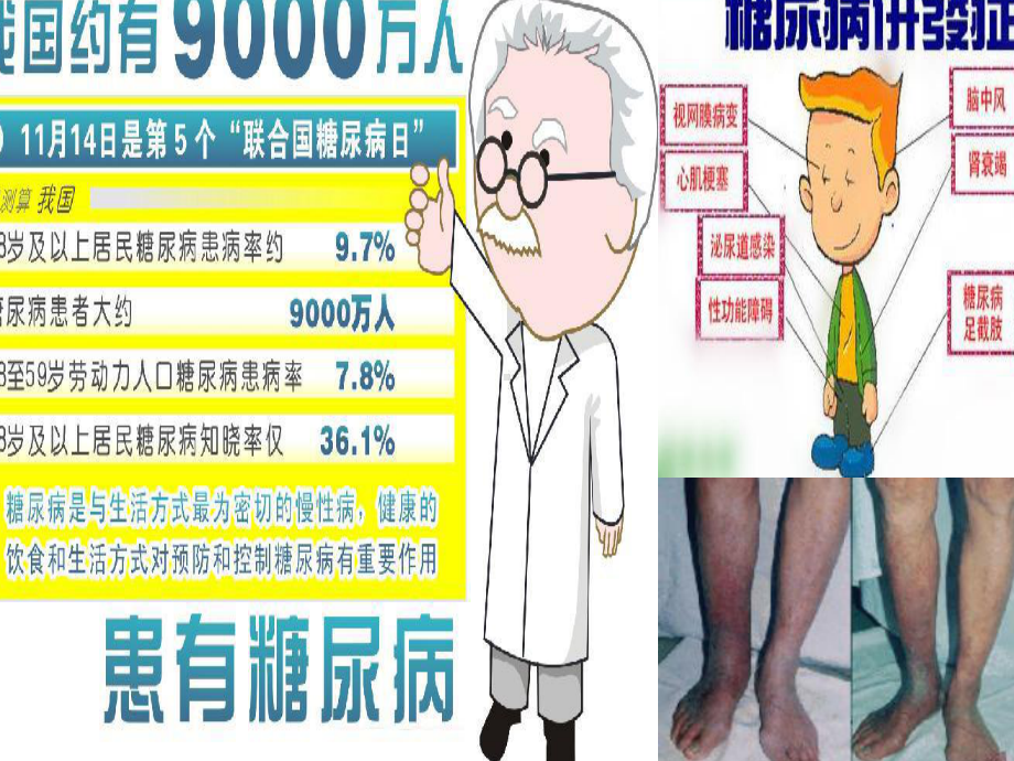 药理学胰岛素和口服抗糖尿病药课件.ppt_第2页