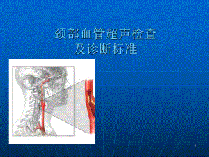 颈部血管超声检查及诊断标准课件.ppt