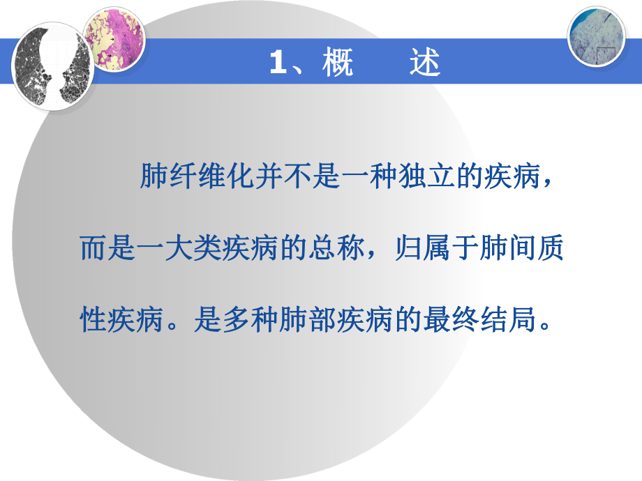 肺纤维化的特点课件.ppt_第2页