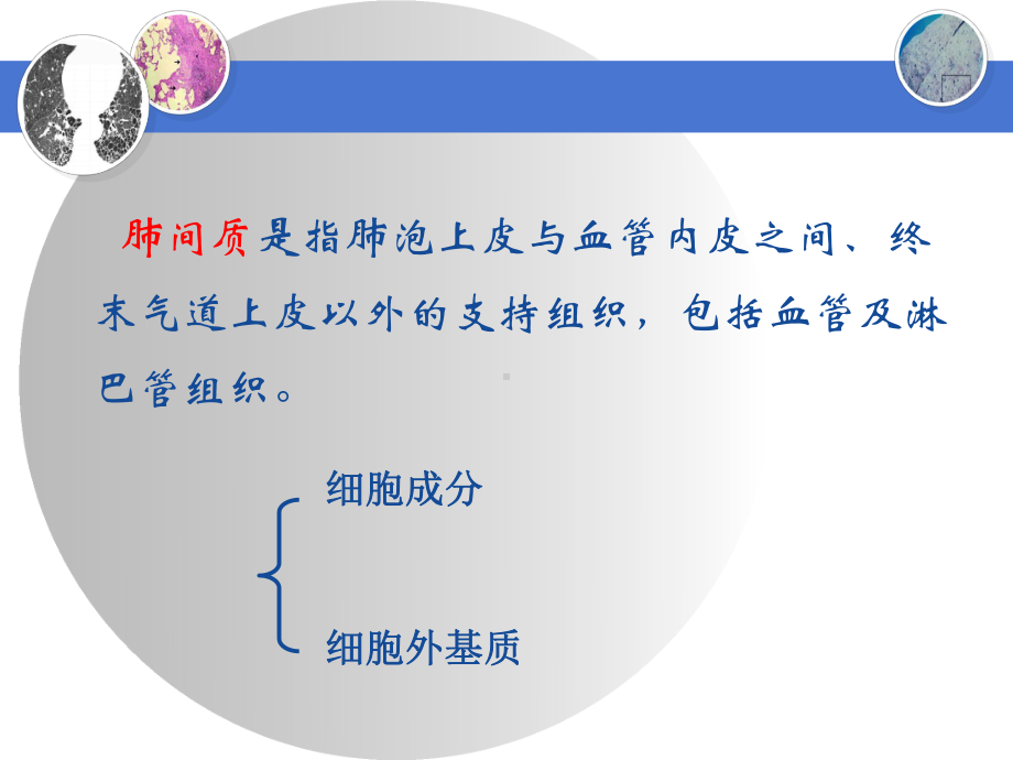 肺纤维化的特点课件.ppt_第3页