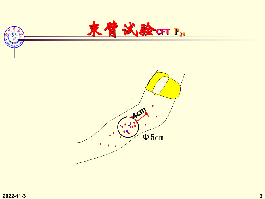 止血与血栓的检验课件.ppt_第3页