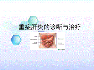 重症肝炎的治疗-课件.ppt