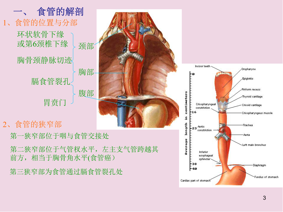 食管癌术式医学课件.ppt_第3页