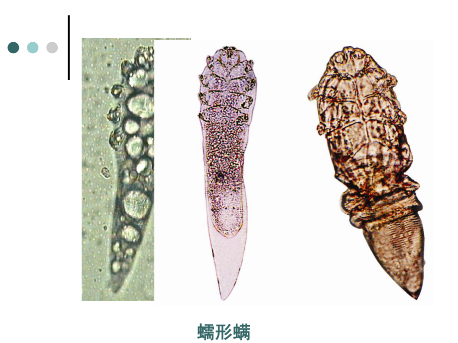 蠕形螨结构图片