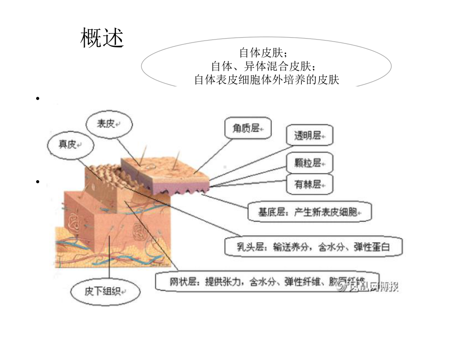 植皮病人的围手术期护理课件.ppt_第3页