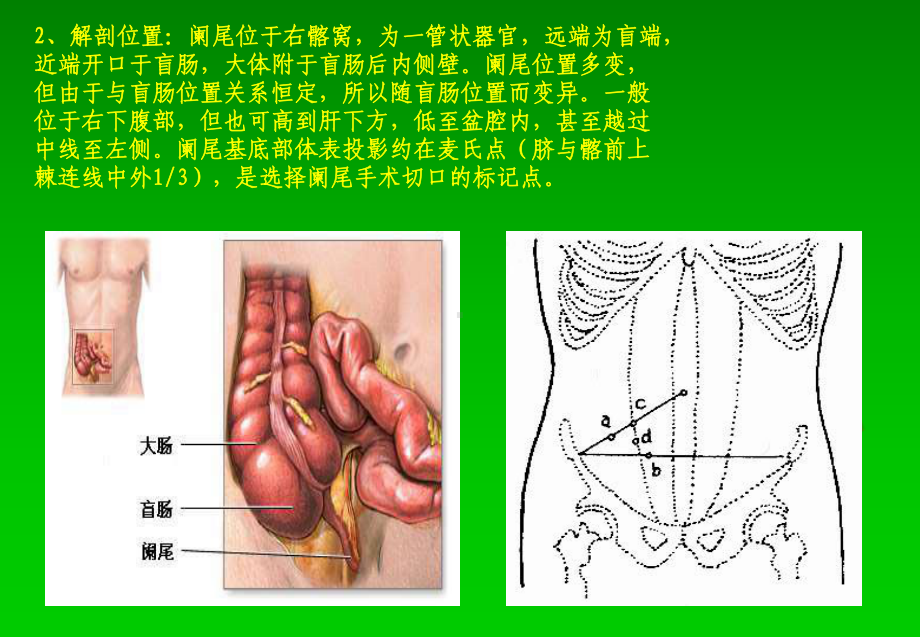 阑尾炎超声诊断汇编课件.ppt_第2页