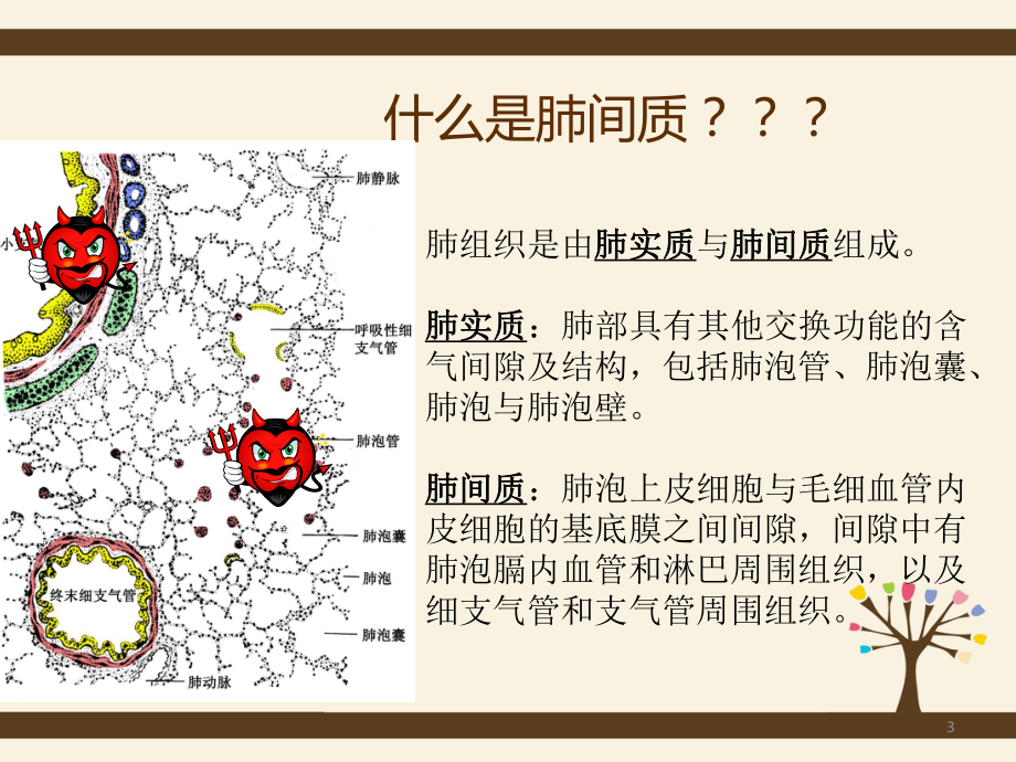 间质性肺炎护理查房课件.ppt_第3页