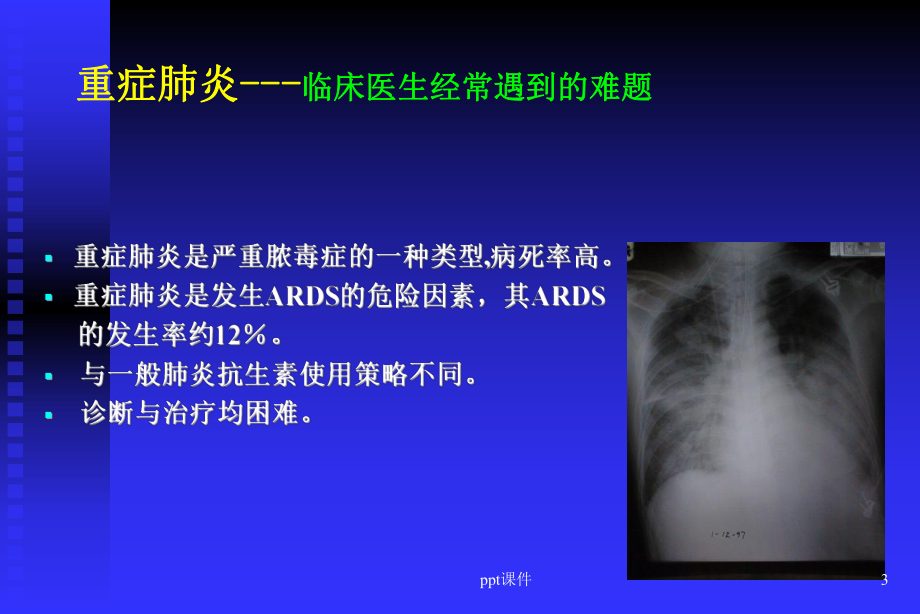 重症肺炎抗生素选择原则-课件.ppt_第3页