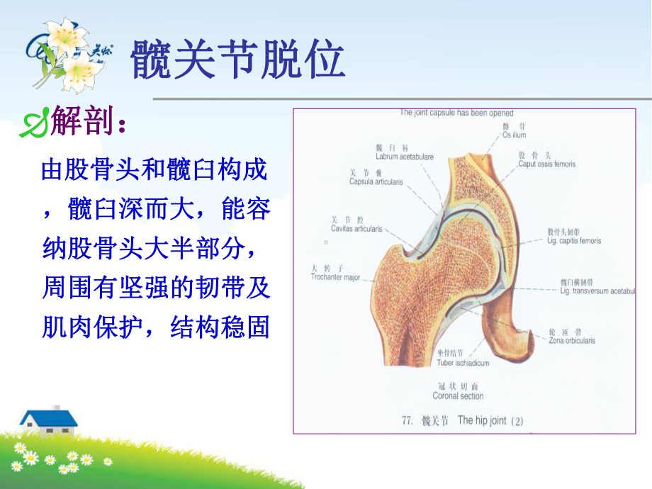 髋关节脱位护理教学讲义课件.ppt_第3页