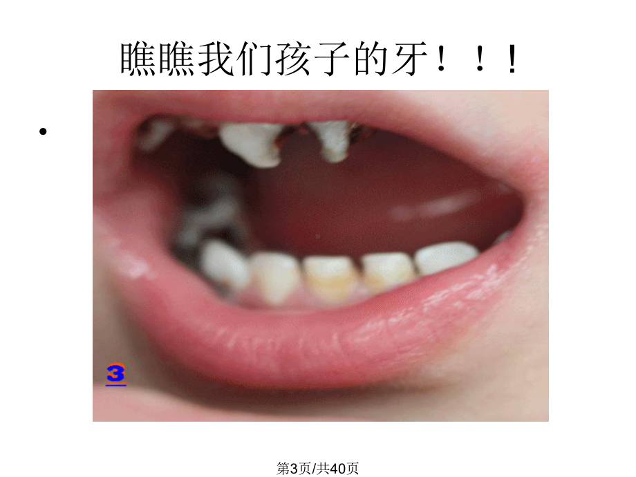 爱牙日教案课件.pptx_第3页