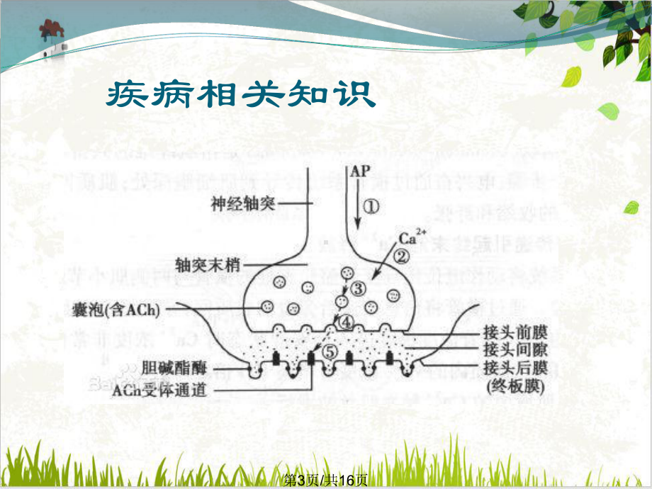 重症肌无力临床特征课件.pptx_第2页