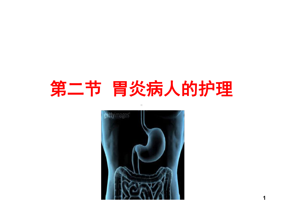 胃炎的护理课件.ppt_第1页