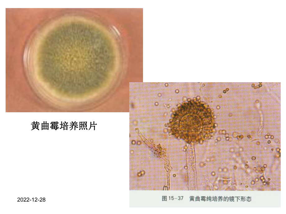 食品的霉菌污染课件.ppt_第3页