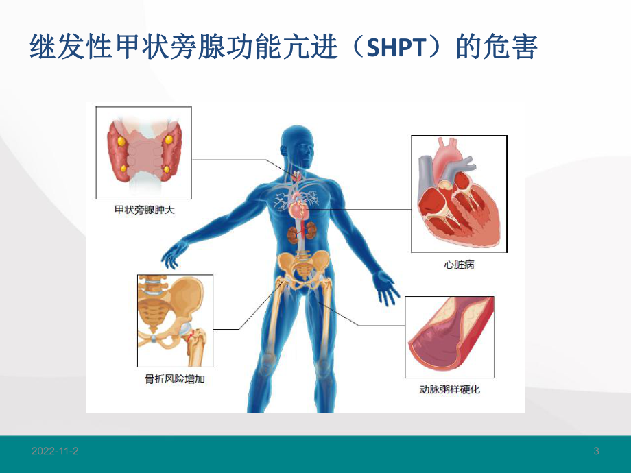 继发性甲旁亢治疗的思考-溉纯和胜普乐的临床有效性课件.pptx_第3页