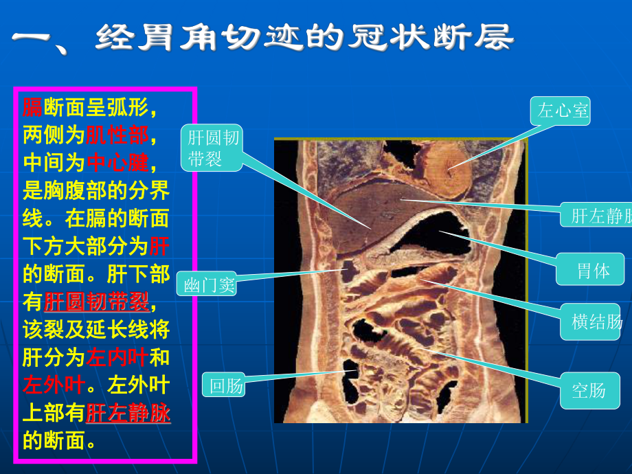 腹部断层解剖第四节腹部冠状断层解剖课件.ppt_第3页