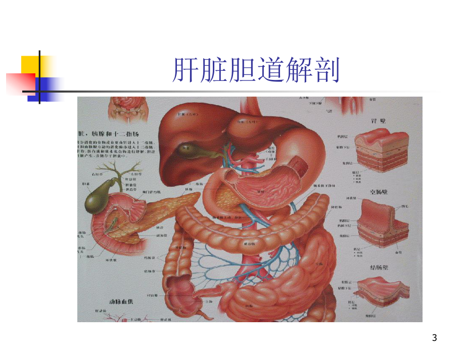 胆管结石医学课件.ppt_第3页