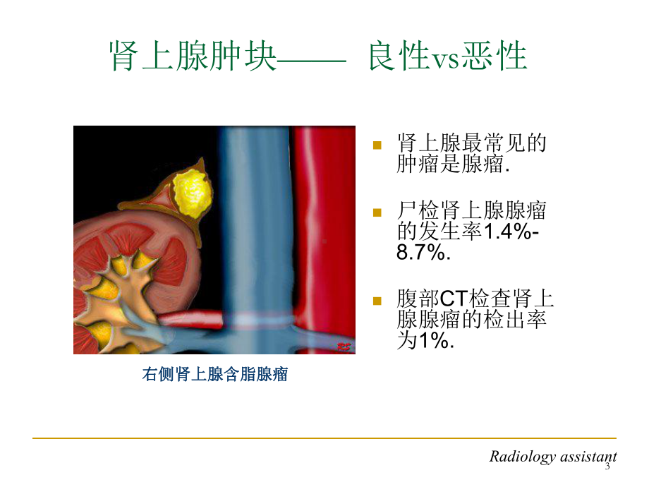 肾上腺占位的CT鉴别诊断(课堂)课件.ppt_第3页