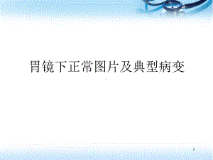 正常胃镜图片及常见病变(课堂)课件.ppt